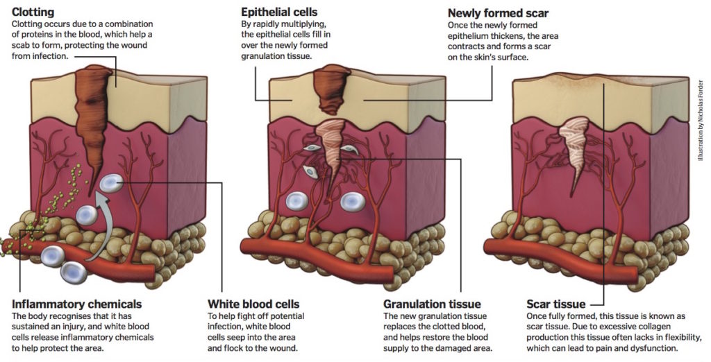 Regenerating skin without scarring