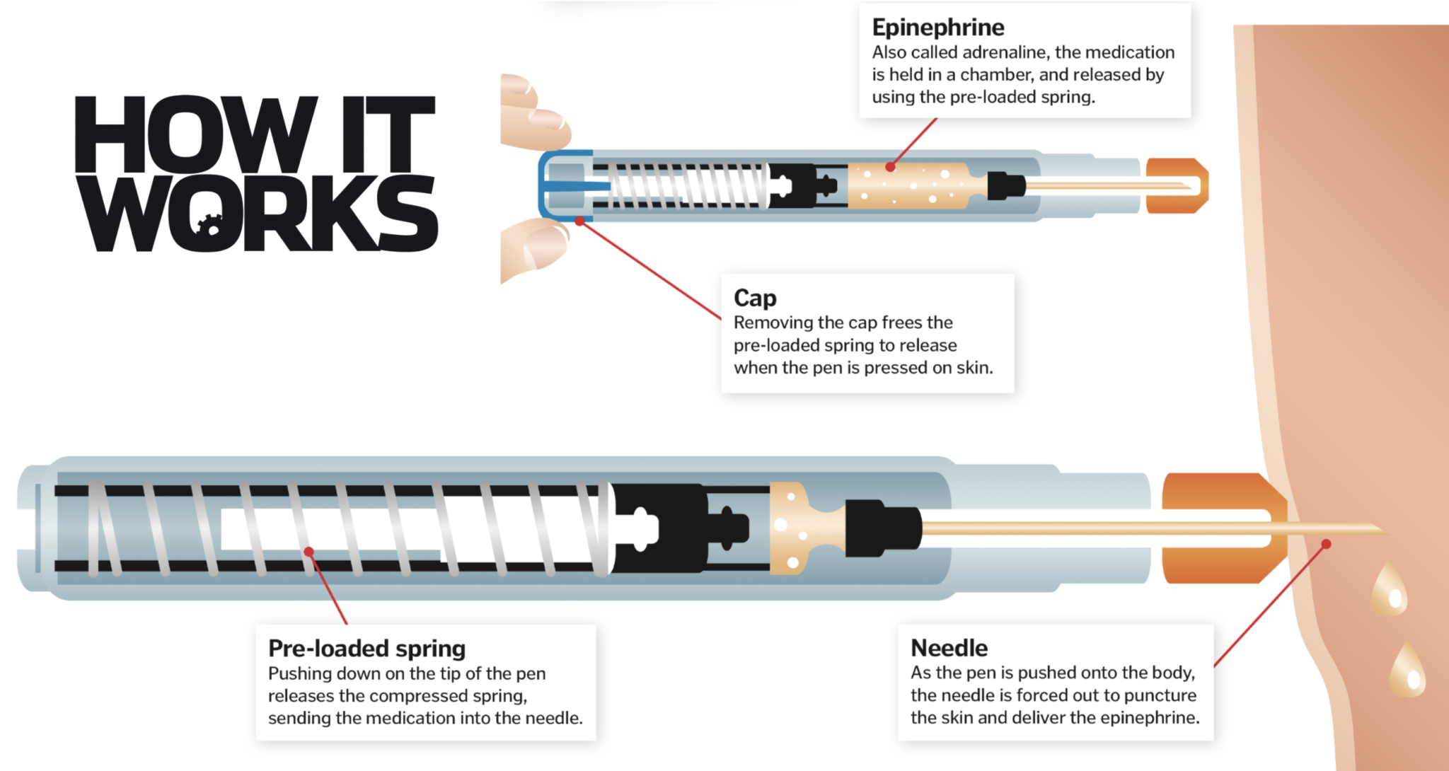 how-do-epipens-work-how-it-works